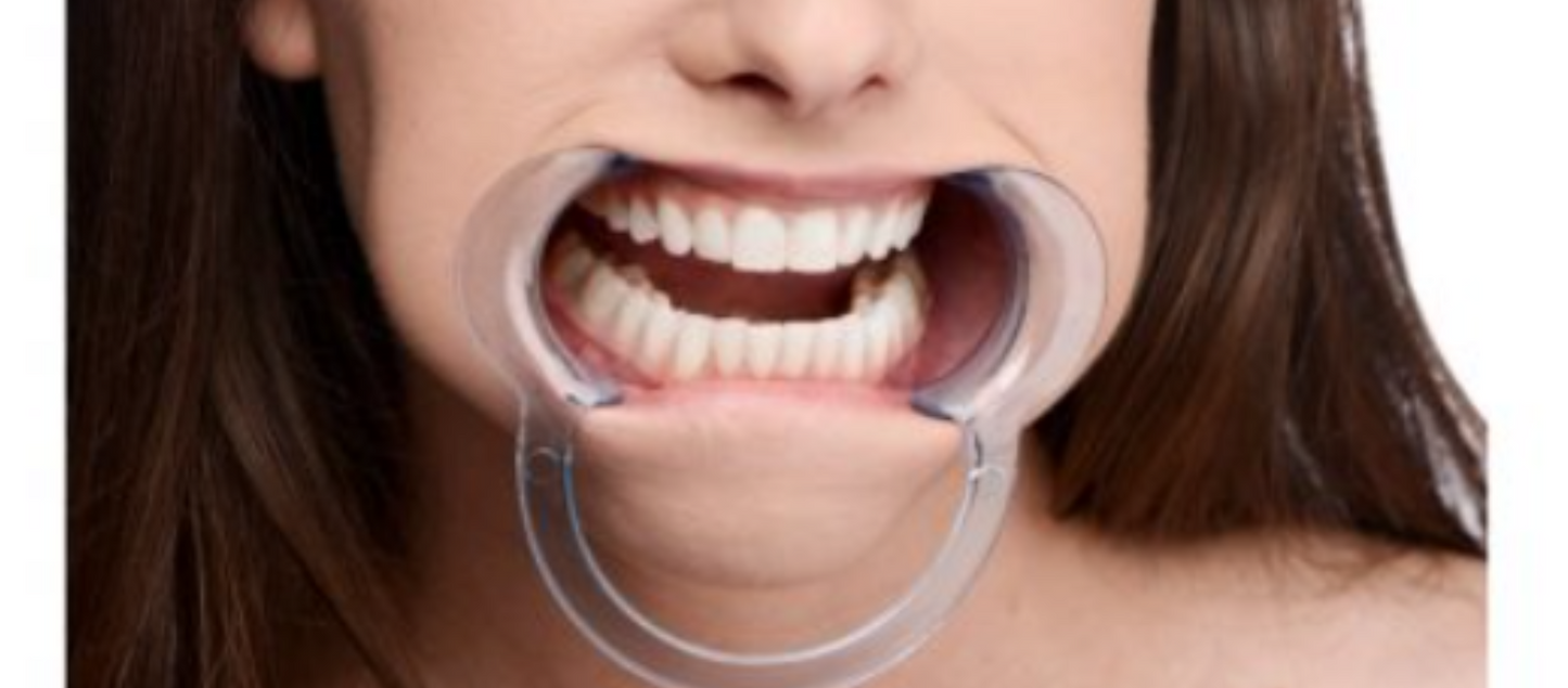 Cheek Retractor Dental Mouth Gag